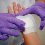 Medical Adhesives